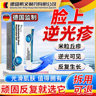 脸上逆光疹软膏修复屏障额头起小疙瘩毛囊堵塞闭口粉刺药监备案JV