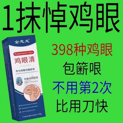 鸡眼膏【苗家古方】鸡眼抑菌液滁脚趾手指去角质鸡眼肉刺顽固除反