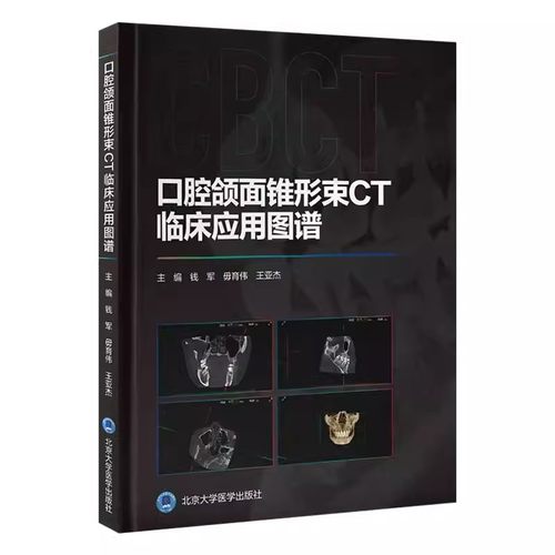 正版口腔颌面锥形束CT临床应用图谱 北京大学医学出版社 本书是供口腔医护 技人员阅读的锥形束CT CBCT 入门级读物 教材书籍