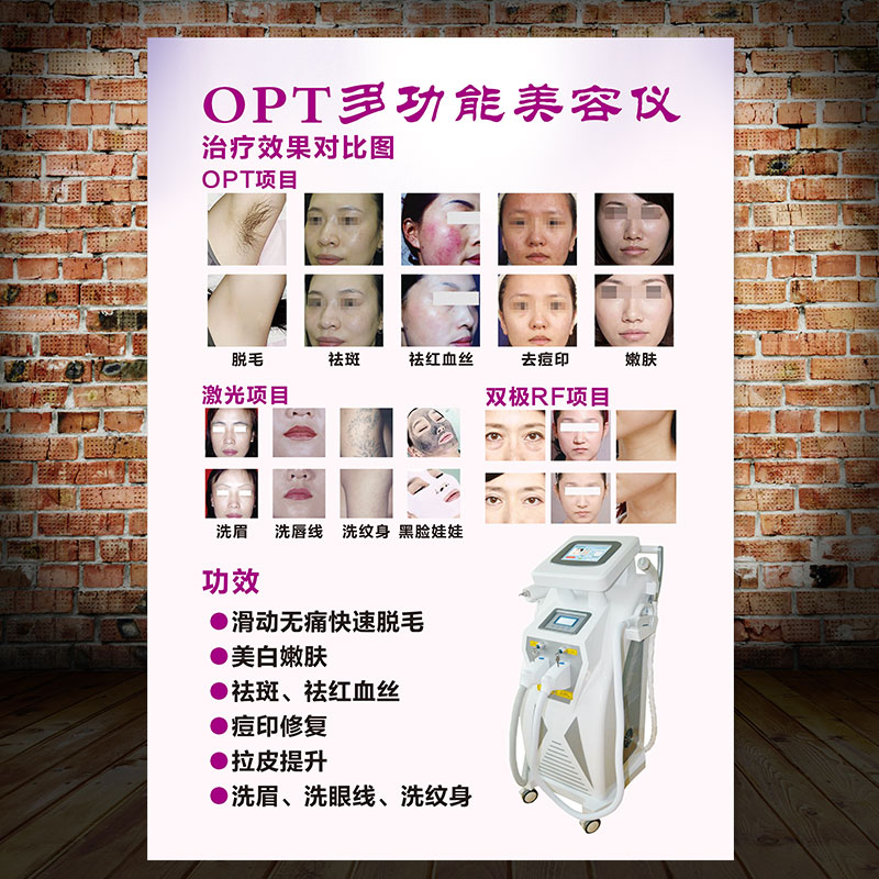 OPT多功能美容仪挂画肩颈海报面部护理图片贴纸美体背景画KT板107