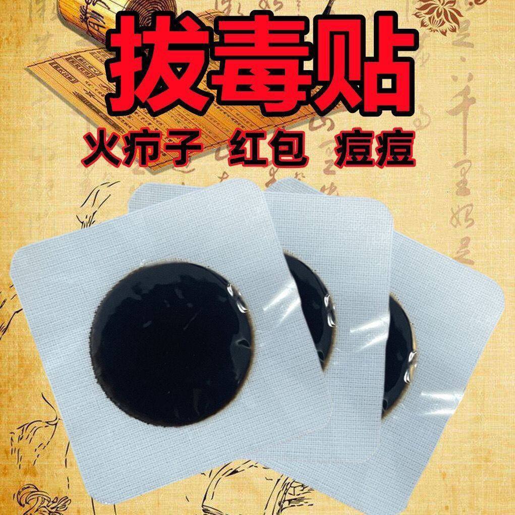 火疖子拔毒贴拔脓贴屁股大红包坐板疮脓包贴硬块吸脓贴痘痘黑膏贴