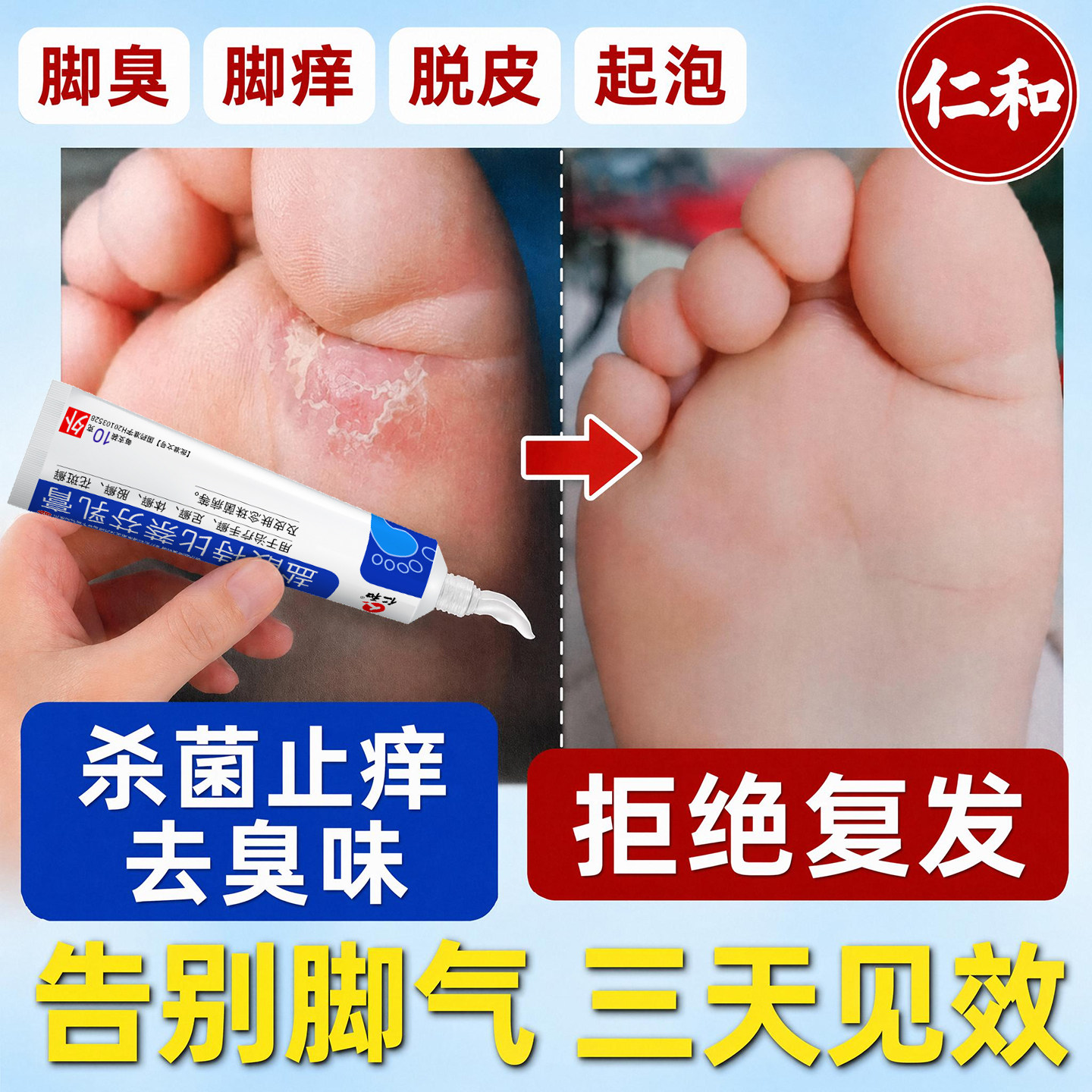仁和治脚气药膏止痒脱皮杀菌真菌感染水泡型治疗烂脚丫足癣专用lx