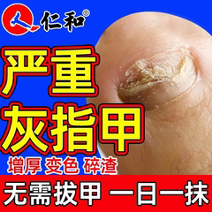 仁和去灰指甲治疗专用药膏真菌感染甲沟炎特效脱甲除正品旗舰店bt