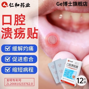 口腔溃疡贴膜嘴巴上火舌头起泡烂嘴角口疮特效专用贴一点灵片喷剂