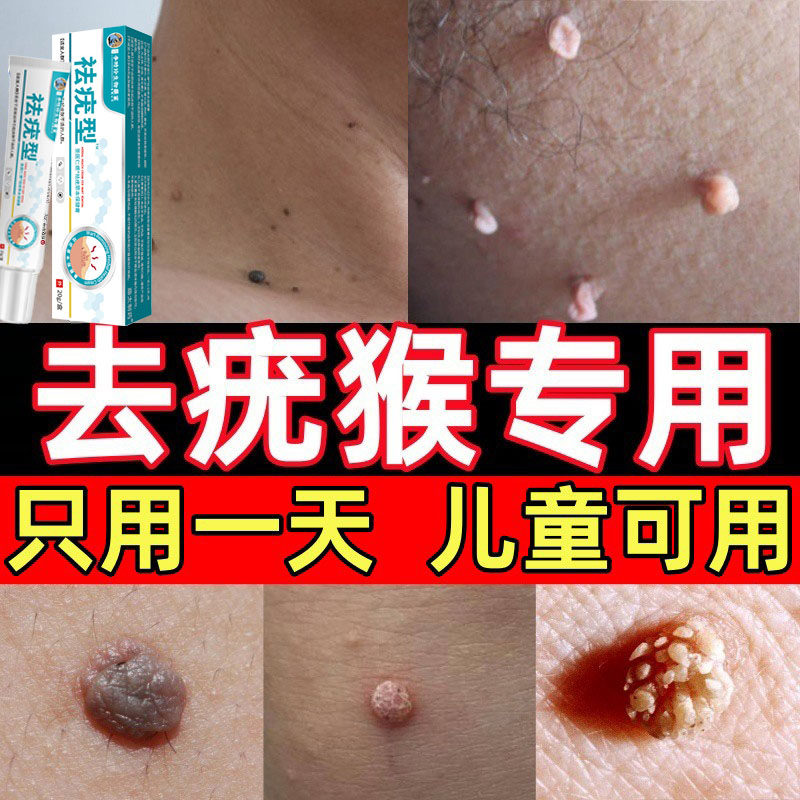 李时珍祛疣跖疣膏专用扁平疣寻常疣一抹灵根立净去除神器正品
