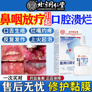 北京同仁堂医用漱口水正品治疗口腔溃疡口舌生疮口臭牙龈杀菌消炎