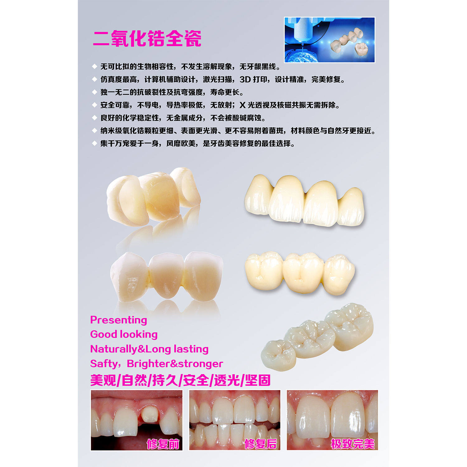 医院口腔科牙科牙齿宣传海报墙贴画二氧化锆全瓷牙全锆牙墙贴海报
