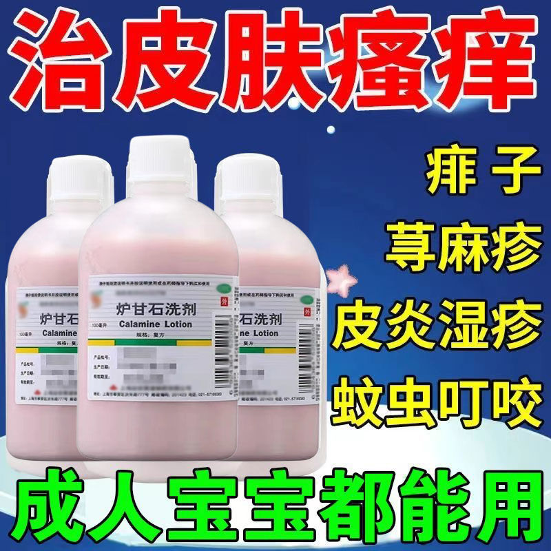 【信龙】炉甘石洗剂100ml*1瓶/盒