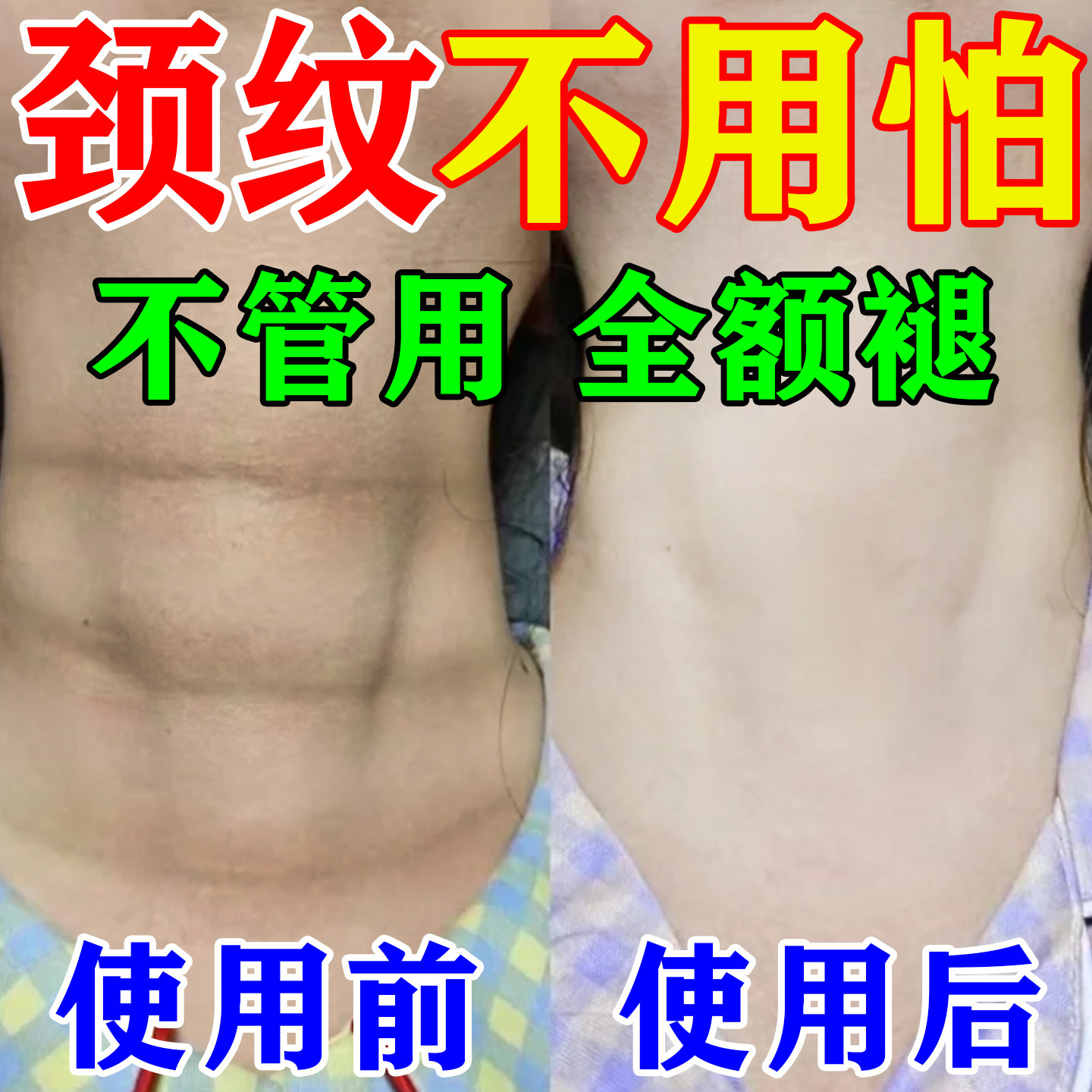 颈霜提拉紧致淡化颈纹