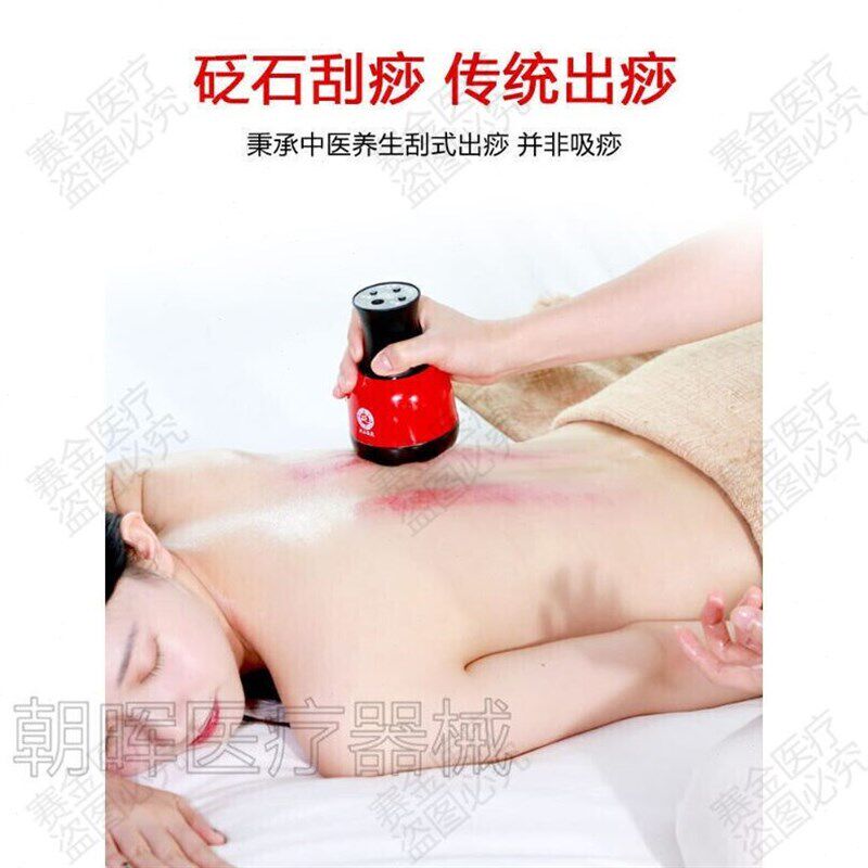 扶阳罐红外理疗砭石温q灸仪刮痧养生罐扶经络器按摩艾电热能量灸