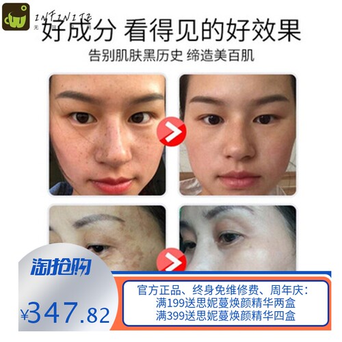 臭臭水疏基水排铅汞去黄褐斑老年斑雀斑黑色素痘印嫩肤增厚角质层