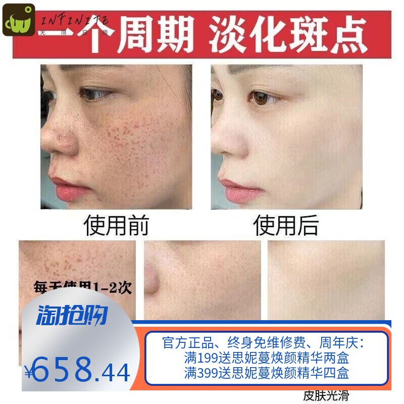 美容院577靓肤焕颜霜 淡斑去黄褐斑雀斑老年斑熊果苷淡斑面霜