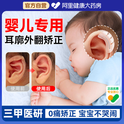 【婴儿专用】耳廓矫正器