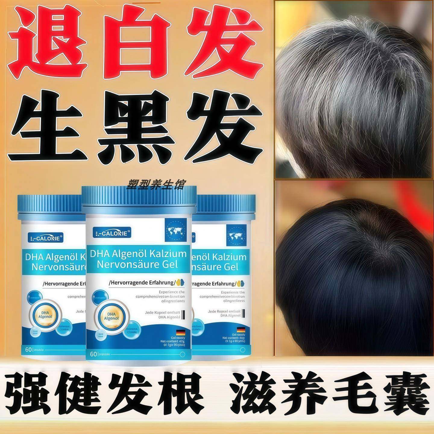 飞维生素D3亚莫欧乌发素卡西奈维生素可园生物素卡爱维生素d3正品,保健食品/膳食营养补充食品,其他膳食营养补充剂,淘宝优惠券,粉丝福利购,淘宝优惠卷