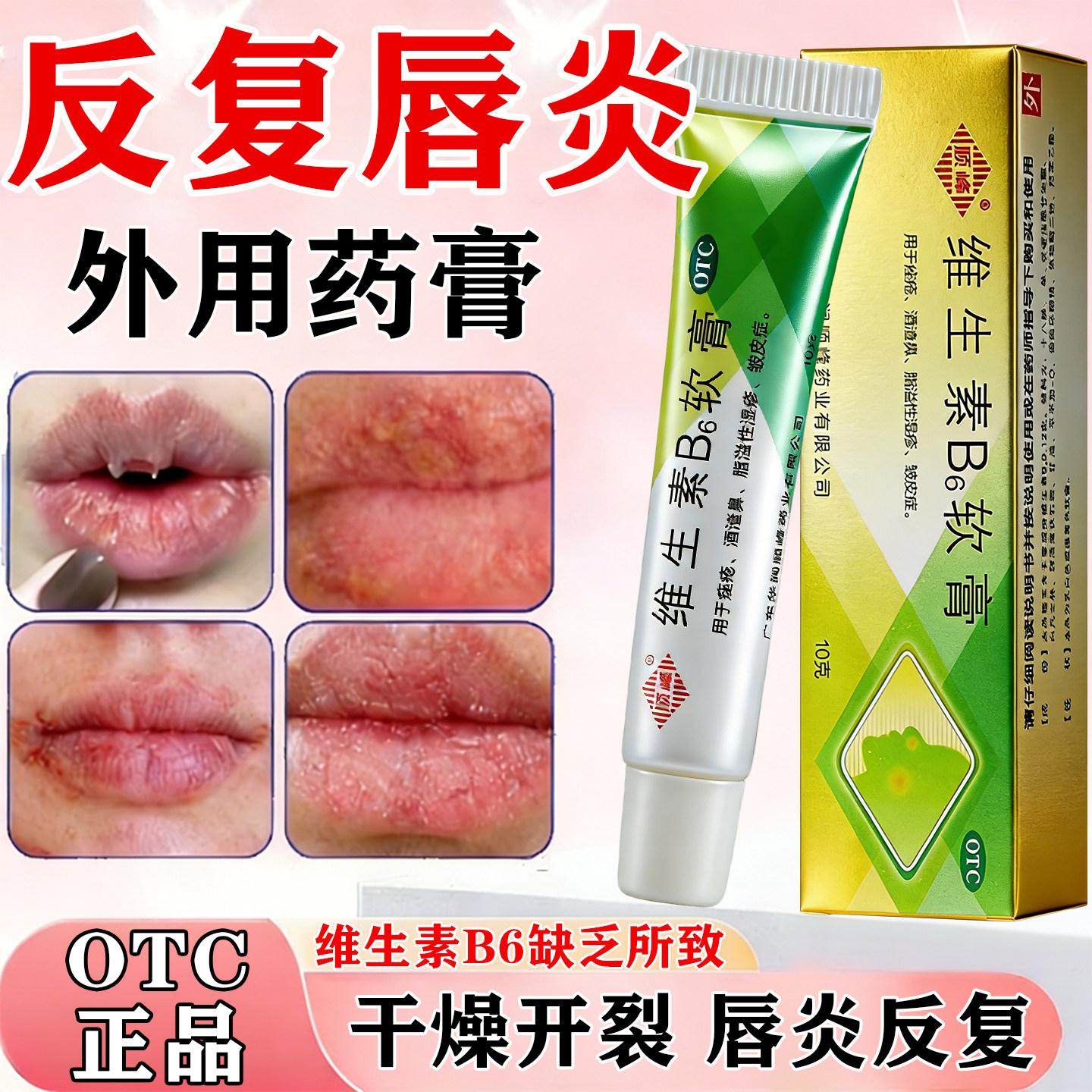 唇炎嘴角烂口角炎烂嘴角药膏嘴唇干裂脱皮唇炎专用药维生素B6软膏