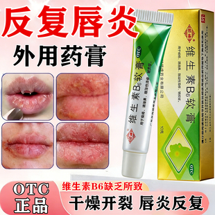 唇炎嘴角烂口角炎烂嘴角药膏嘴唇干裂脱皮唇炎专用药维生素B6软膏