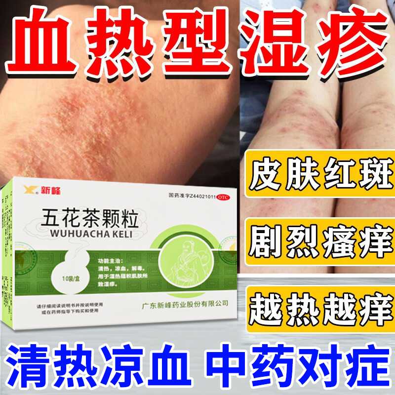 湿疹止痒成人湿疹专用药湿热性湿疹皮肤瘙痒红斑丘疹五花茶颗粒