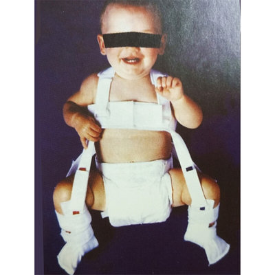 厂包邮婴儿连衣挽具 婴幼儿髋关节发育不良 髋外展矫形器 蛙式支