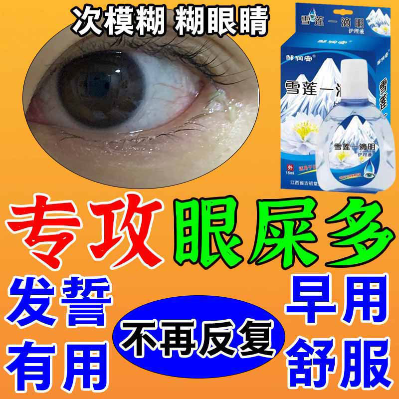 雪莲一滴明眼睛干涩熬夜眼底红血缓解眼泪疲劳视物模糊护眼液lt