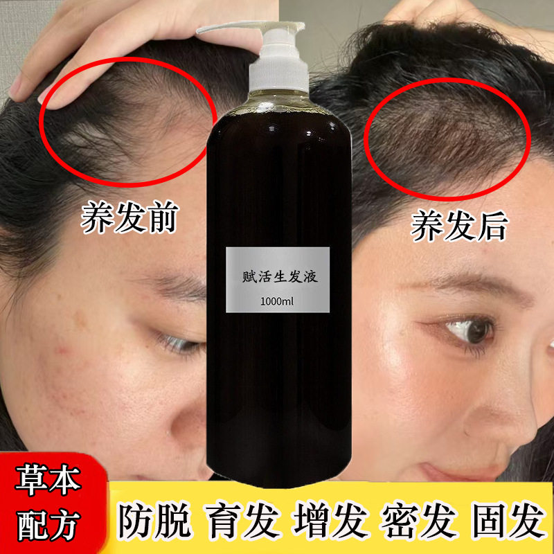生发液增发密发修复发根头皮发际线密发蓬松植物防脱育发液增发液