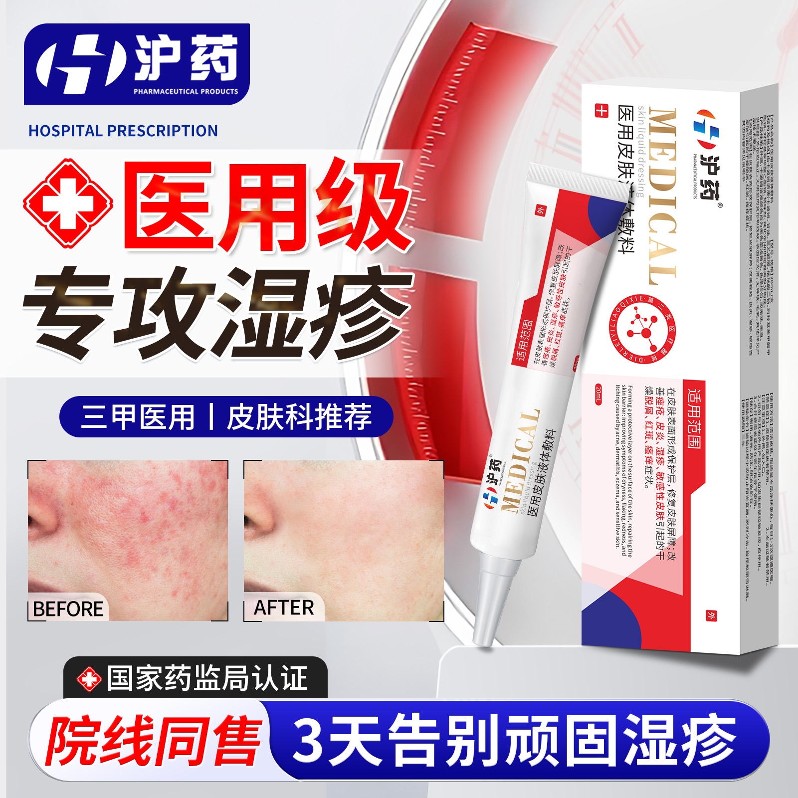 【三甲医用】N0.1专攻湿疹汗疱疹