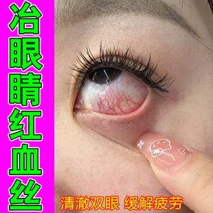 冶眼睛红血丝修复去黄眼疲劳粘稠去黄斑视物模糊眼里有异物滴眼液