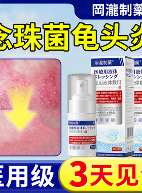 念珠菌性龟头炎男性私处专用真菌感染珍珠丘疹包皮白垢特效喷剂