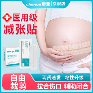 晨业减张贴剖腹产医用皮肤免伤口缝拉链式减张器刨腹产张力贴