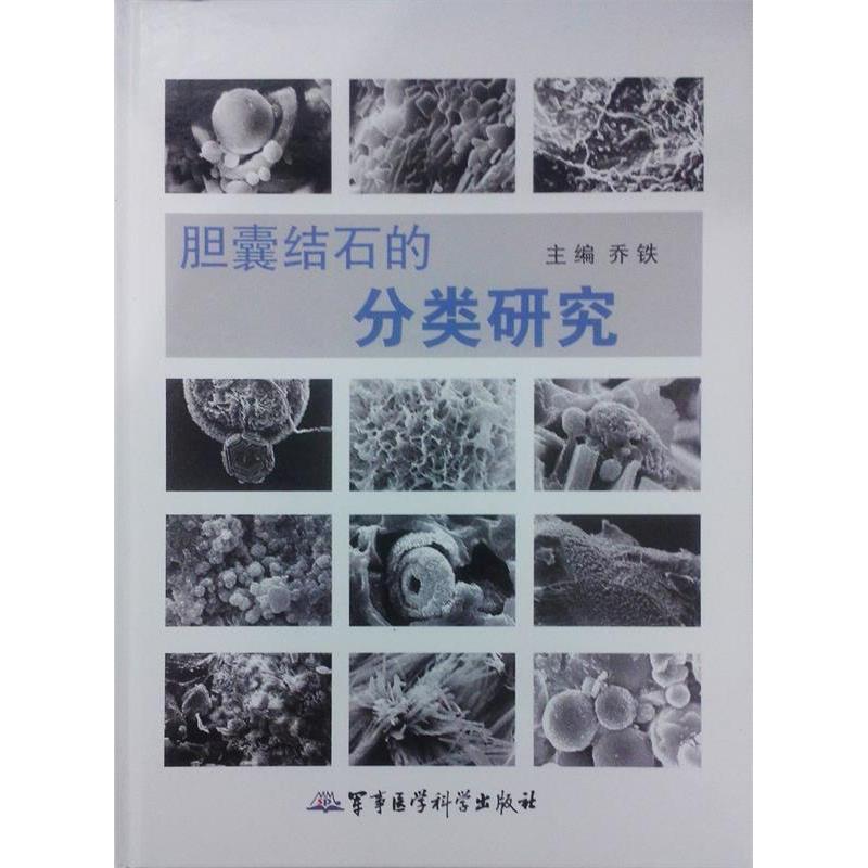 正版胆囊结石的分类研究