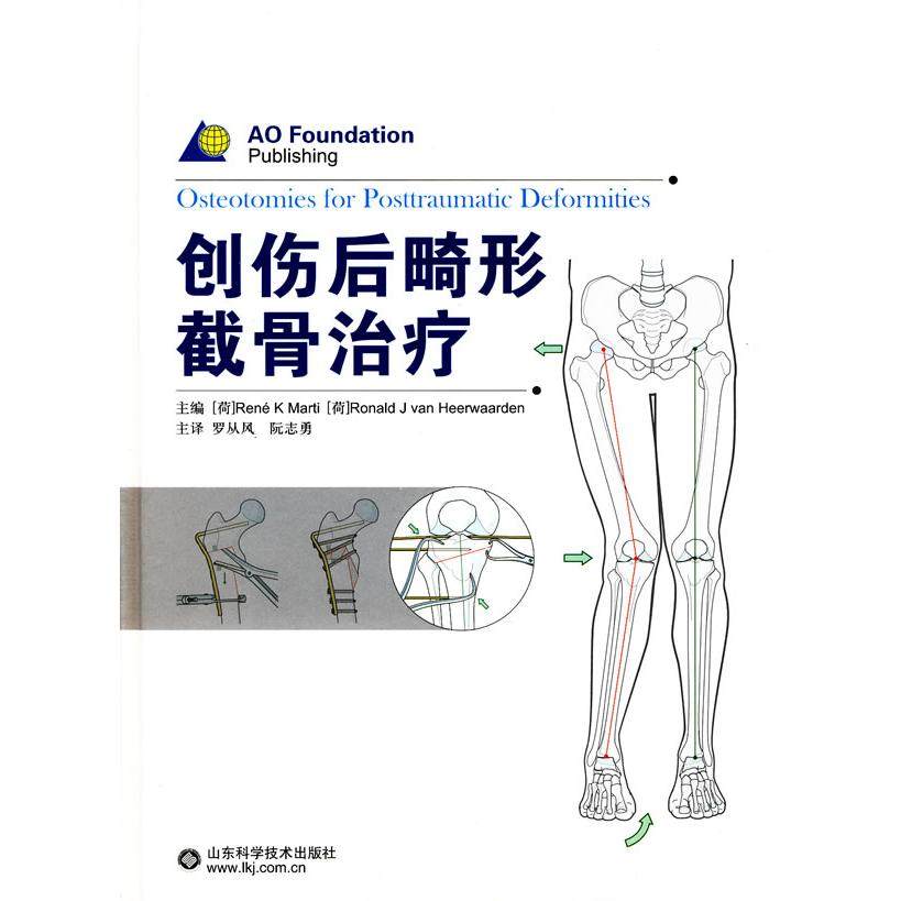 创伤后畸形截骨治疗正版,书籍/杂志/报纸,建筑/水利（新）,淘宝优惠券,粉丝福利购,淘宝优惠卷
