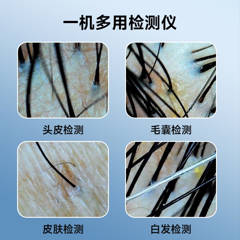 家用头皮头囊检测仪数码高清100W像素I电子显微镜可拍照皮肤检测