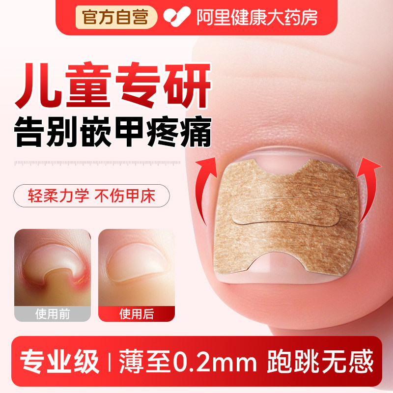 正甲贴甲沟矫正器儿童专用嵌甲贴片炎脚趾指甲长肉里专业纠正神器