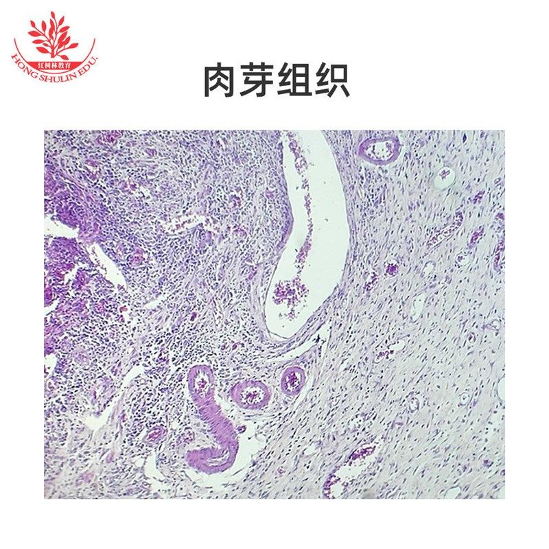 病理切片HE玻片细n胞明显细胞核显示鲜亮细胞膜染色病理清楚标本