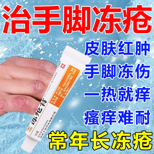 治冻疮药手脚冻疮冻伤膏冻疮反复红肿手脚干裂止痒冻手药膏冻疮膏
