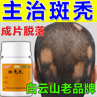 治斑秃药白云山斑秃丸鬼剃头头发成片脱发头发稀少掉发秃顶谢顶