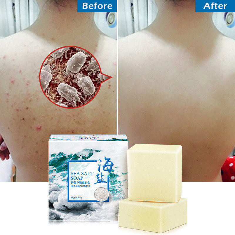 极速Sea Salt Cileaner oil control Anti acne treatment body S