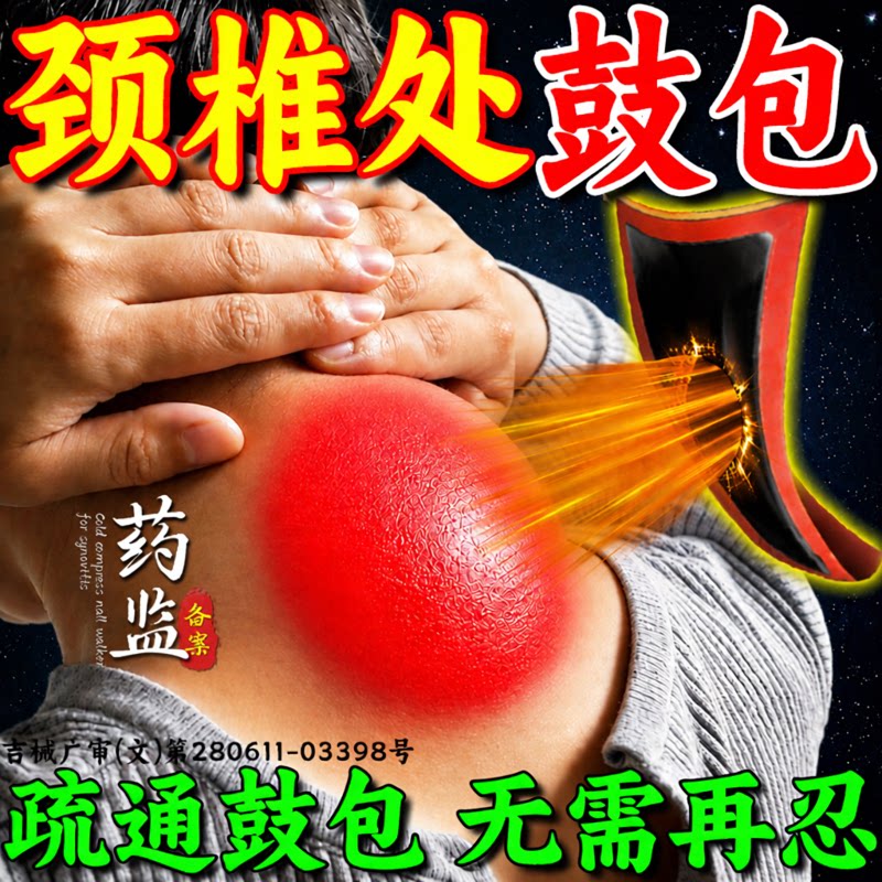 颈椎病富贵包消除贴正品脖子疏通神器鼓包大椎穴祛淤堵涨膏药按摩 品摩实拍商品图