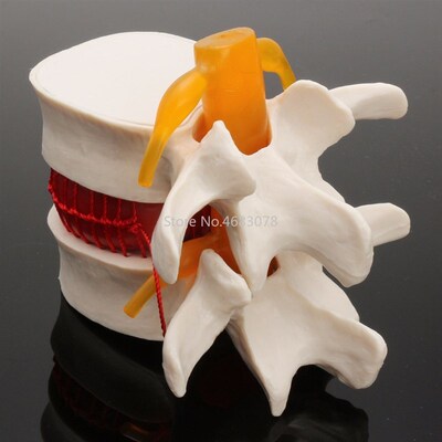 Dental 11 Human anatomy skeleton SFpine Lumbar Disc Herniati
