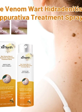 Bee Venom Wart Treatment Spray Skin Cleansing Repairing Fadi