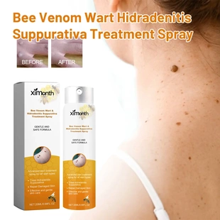 Treatment Spray Skin Bee Repairing Wart Cleansing Fadi Venom