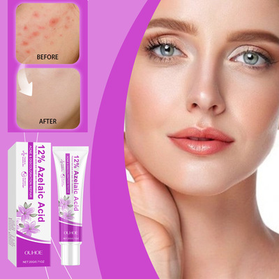 OUHOE壬二酸痘痘护理霜淡化改善