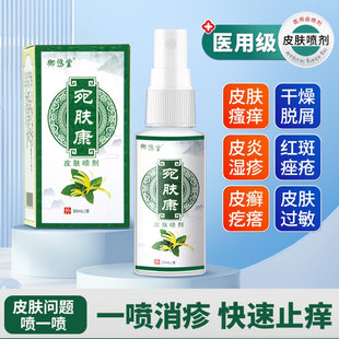 宛肤康喷剂手上脚上全身皮肤可用手足前胸后背四肢私处止痒