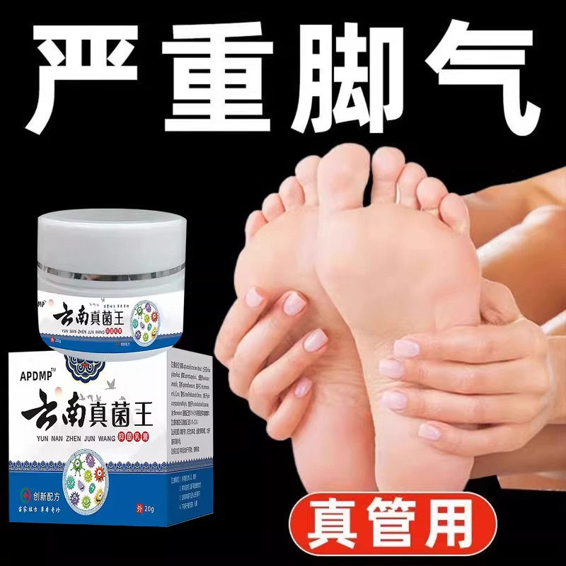 云南真菌王脚/气有泡痒脚烂了脚缝痒烂脚痒防止水泡脚脱皮脚趾臭