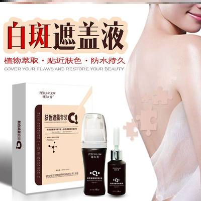 极速白斑遮盖液防水白癜风外用生长Z盖脱林神器