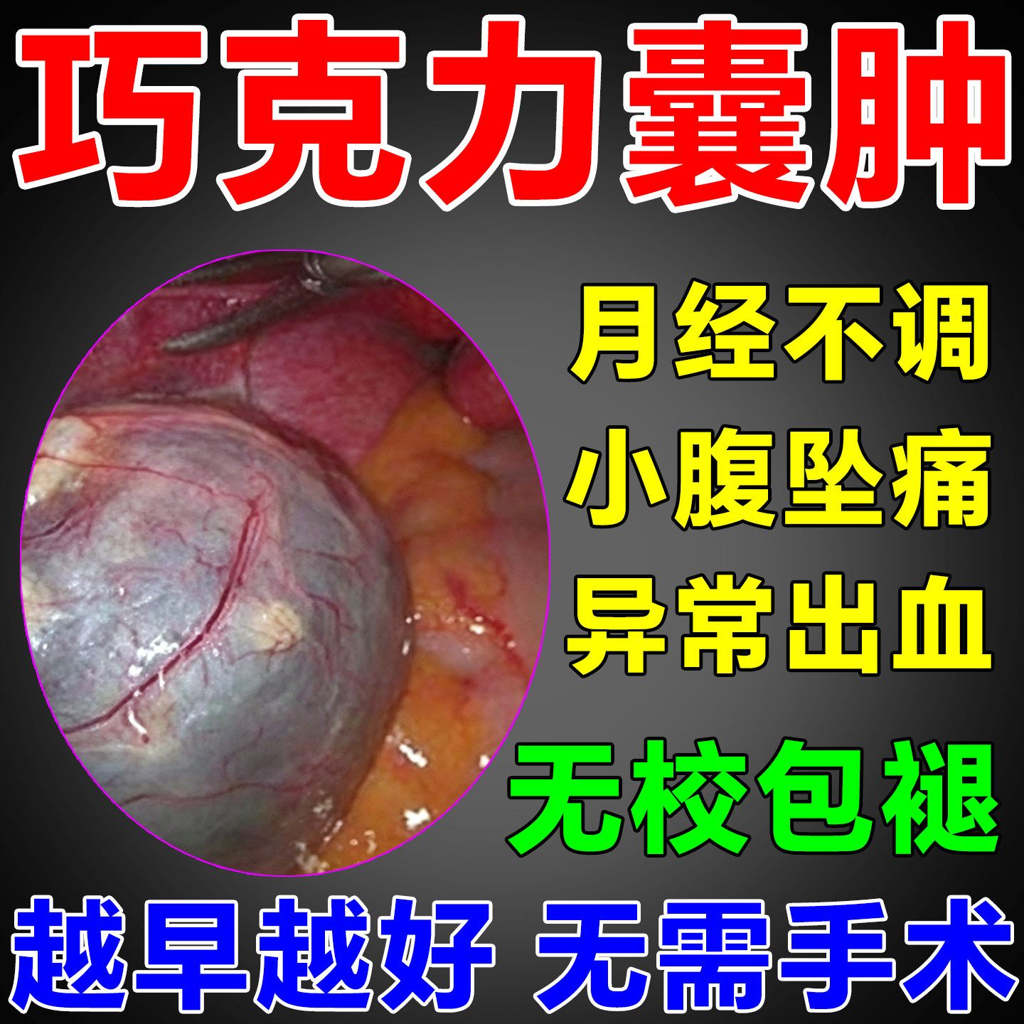 巧克力囊肿暖宫贴【纯中药成分】