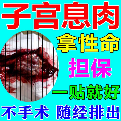 子宫息肉药贴】一贴排出无效全退