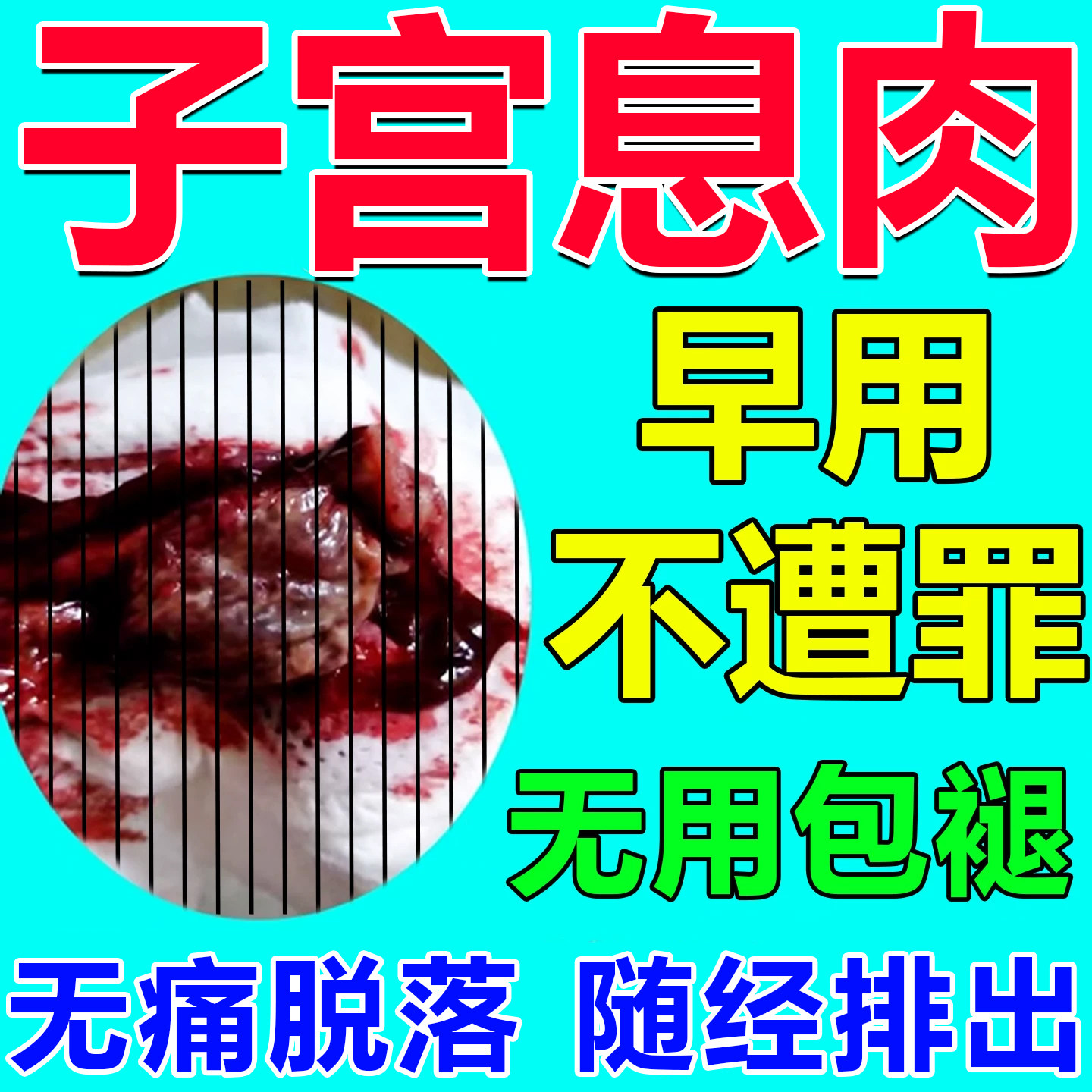 子宫内膜息肉药内膜太厚中药调理宫颈纳囊肥大肌瘤专用去除宫舒贴