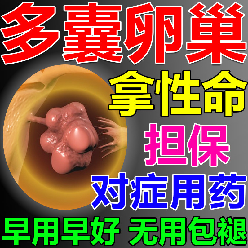 多囊卵巢综合征调理内分泌失调月经闭经促排卵助孕肥胖量少闭停贴