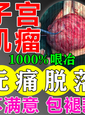 子宫肌瘤中药贴消除内膜息肉体质虚寒治疗子宫肌瘤特效膏药暖宫贴