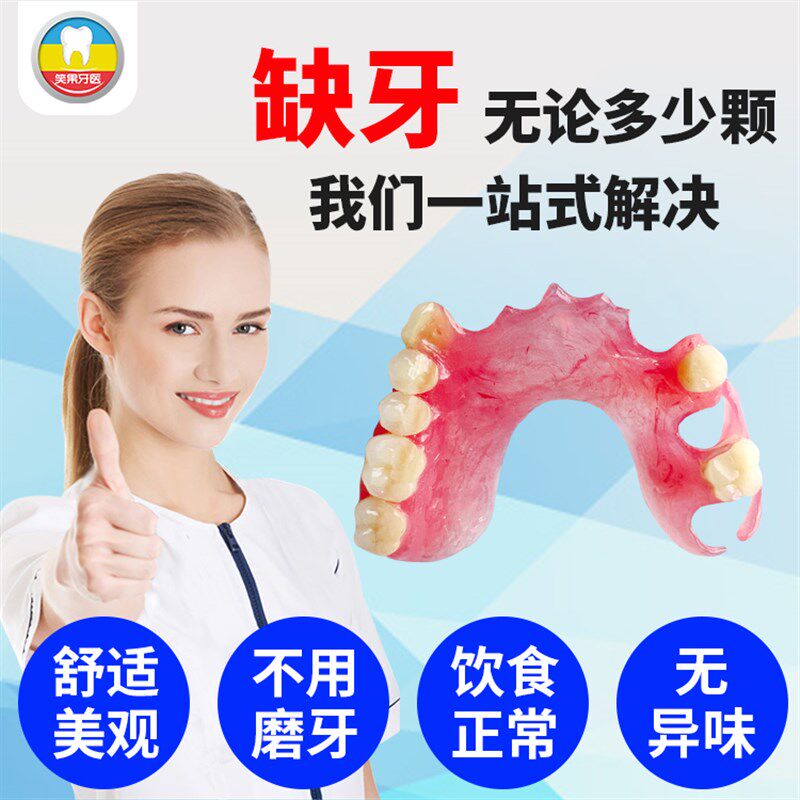 缺牙定制活动假牙义齿树脂门牙掉缺牙镶牙种植Q牙临时遮丑修复神